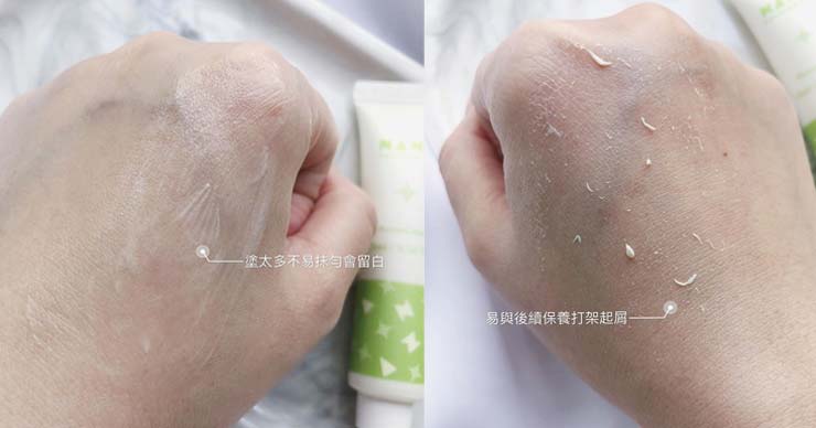 美膚娜娜糾痘乳膏使用心得分享